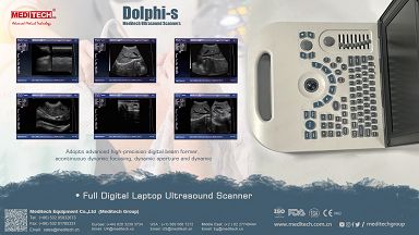 Ultrasound Scanner adopts advanced high-precision 